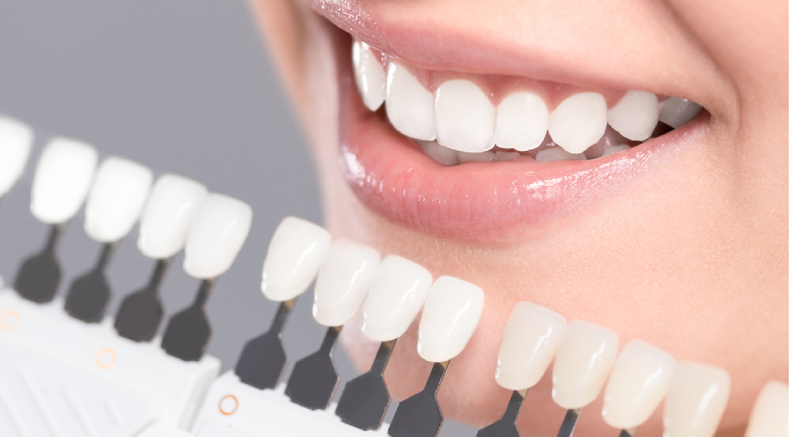 Cosmetic Dentistry: Bright Way Dental Clinic, Best Dental Clinic for Cosmetic Dentistry in Dubai.