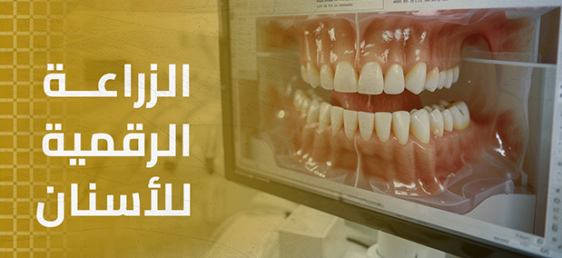 تقويم الأسنان الشفاف في عيادة برايت واي: استخدام أداة Invisalign لتصحيح الأسنان دون الحاجة للأقواس المعدنية.