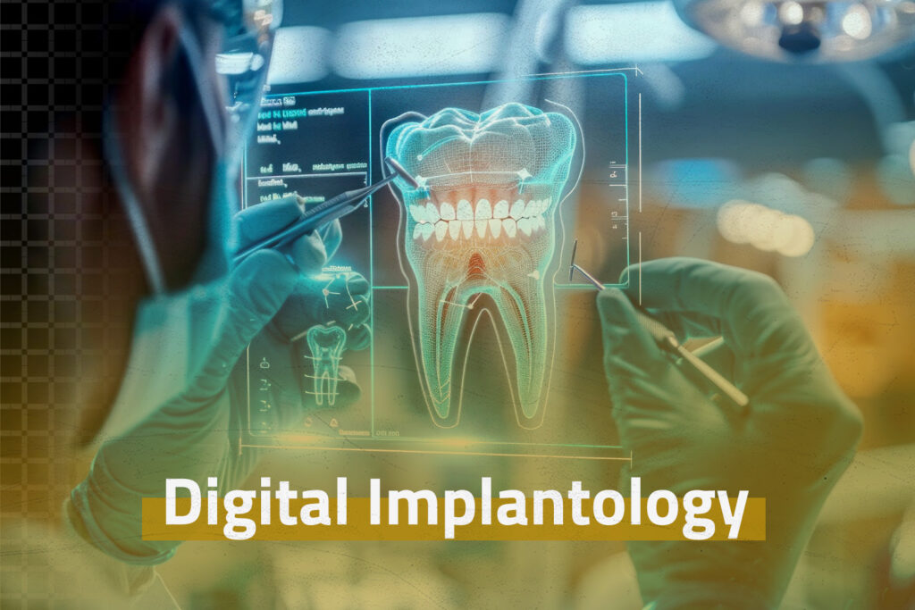 "Dental implant procedure at Bright Way Dental Clinic, Dubai for missing teeth replacement."