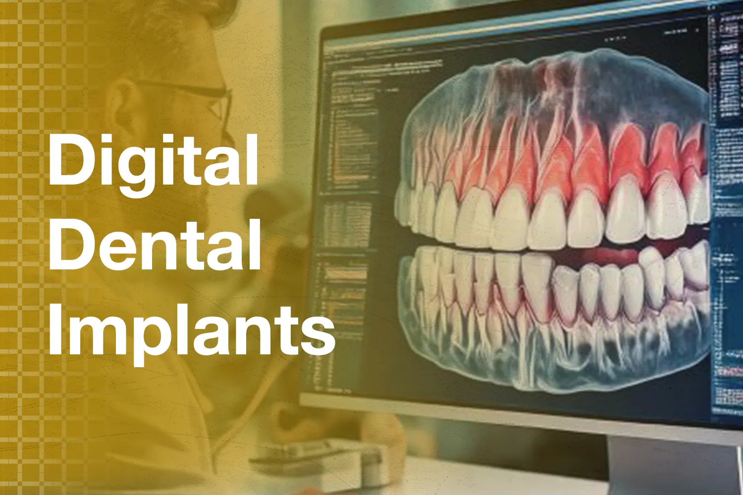 صورة تُظهر شاشة حاسوب تعرض نموذج ثلاثي الأبعاد للأسنان والفك مع نص زراعة الأسنان الرقمية
