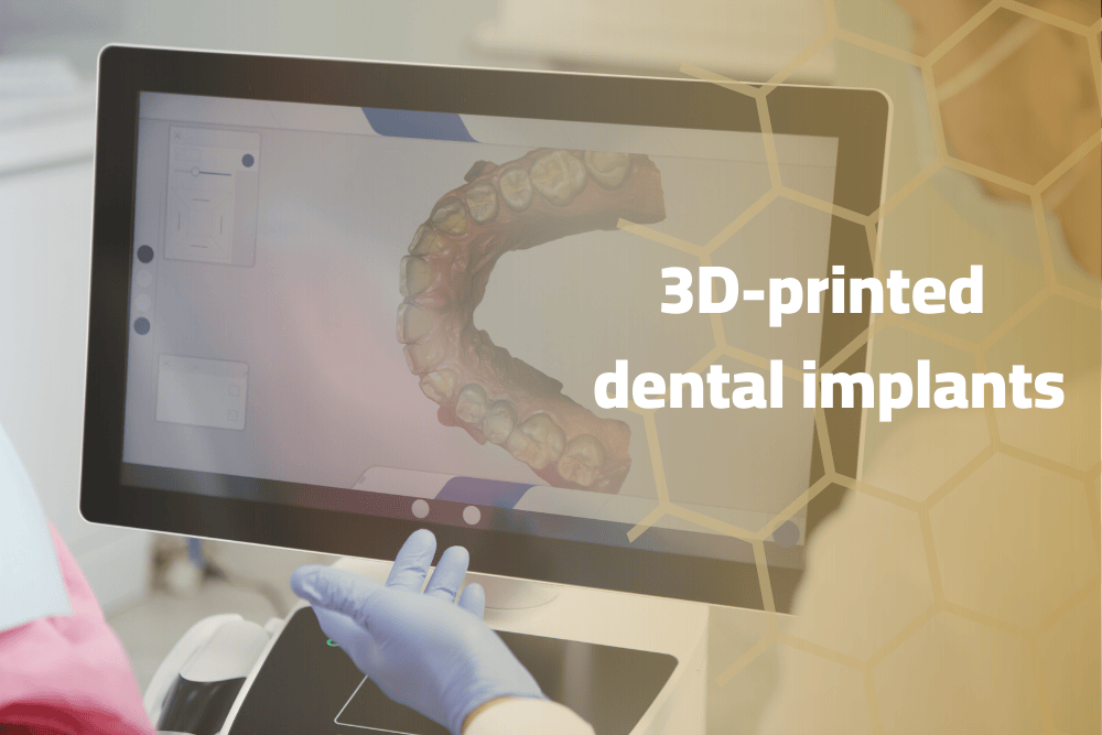 3D-printed dental implants offer customizability and precision, made from advanced materials like titanium for greater durability.