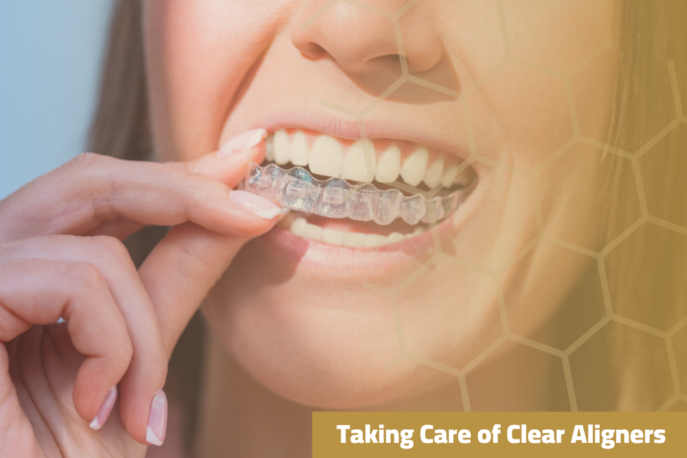 Clear aligners held in hand, emphasizing proper care and cleanliness.